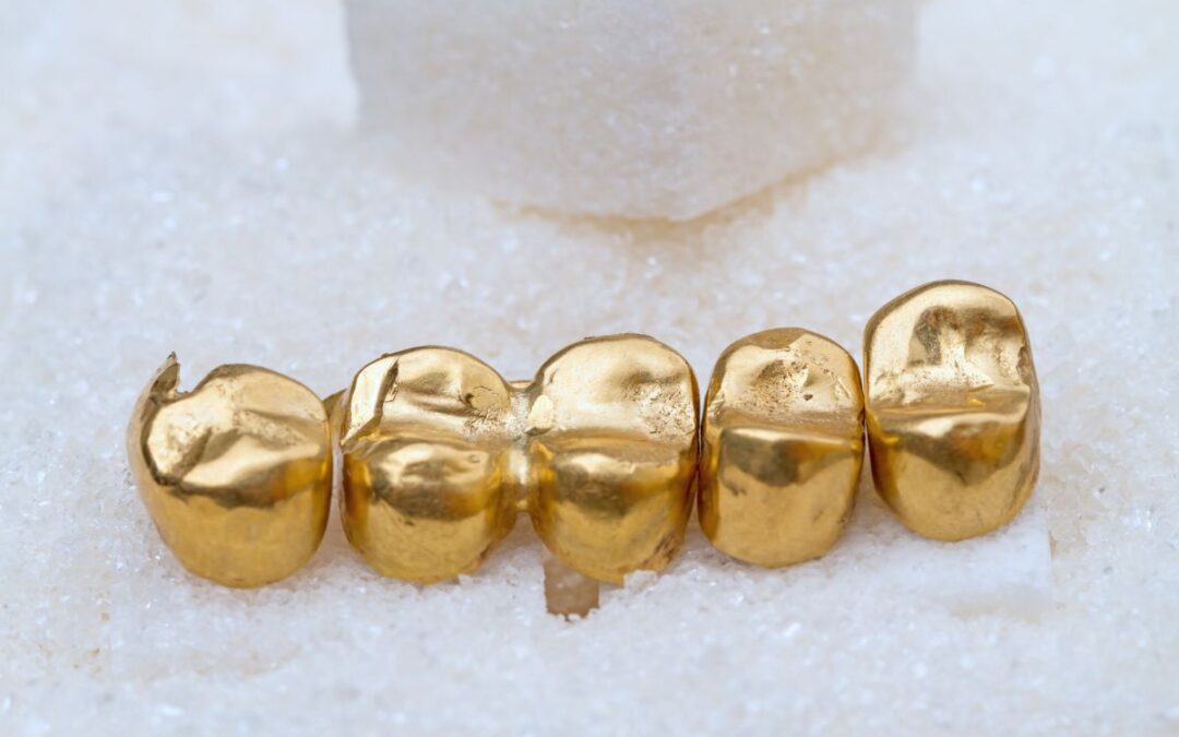 valutazione denti oro